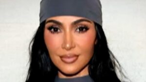 Kim Kardashian discloses brain aneurysm diagnosis. What are common signs? – Detroit Free Press
